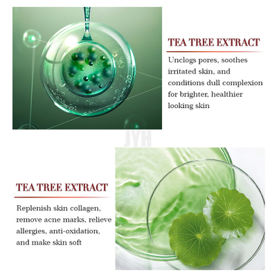 removedor orgánico de la espinilla del acné de la reparación del suero de la cara de la esencia del alivio del árbol del té del OEM 1oz/30ml
