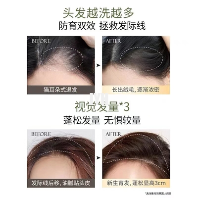 gel natural de la ducha del champú orgánico del ODM 400ml para el sistema del crecimiento del pelo