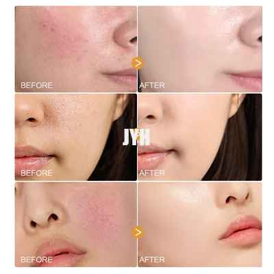 MSDS Productos para el cuidado de la piel facial Suero orgánico de pétalos de manzanilla Suero facial natural para pieles sensibles