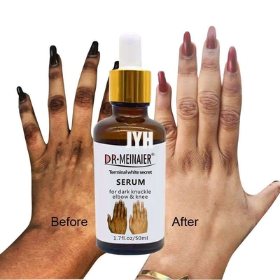Cosméticos de GMPC Bodycare que blanquean el suero del resplandor del nudillo de la mano para quitar el codo oscuro del nudillo