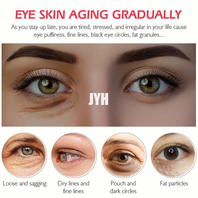 proteína de los cosméticos del Eyecare 20g que consolida y que aligera las líneas finas que hidratan la crema del ojo