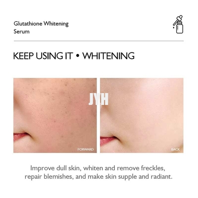 Glutatión Cuidado de la piel Esencia Suero facial Blanqueamiento Anti envejecimiento Suero facial para pecas