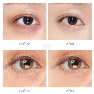 Polipéptido cosmético para el cuidado de los ojos de los años 60 para eliminar las bolsas de los ojos y diluir las líneas finas Crema de ojos con efecto lifting de comercio exterior